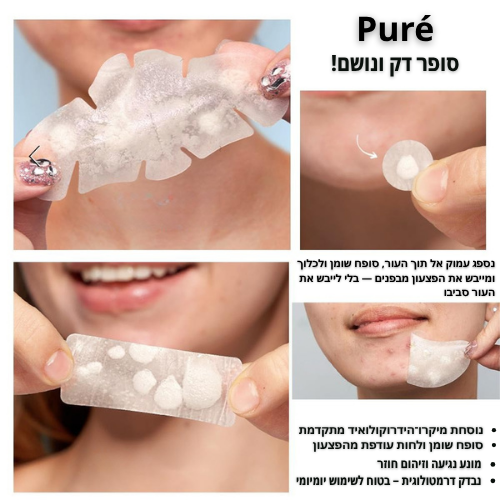 Puré - ערכת שמן עץ התה אוסטרלית וטבעית לטיפול באקנה
